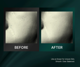 Medifault Phytogenpeel Ampoule 60ml, Skin Texture Keratin Whitehead Improvement,Kbeauty