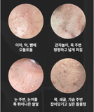 Medifault Phytogenpeel Ampoule 60ml, Skin Texture Keratin Whitehead Improvement,Kbeauty