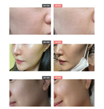 Coopy PDRN YEON-UH Derma Face Mask 23ml x 5 Sheets, Hydrating Moisturizing