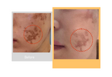Dr. Drawing Vita C Serum 30ml
